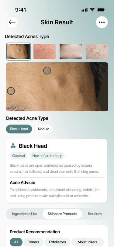 SkinNavi app screen